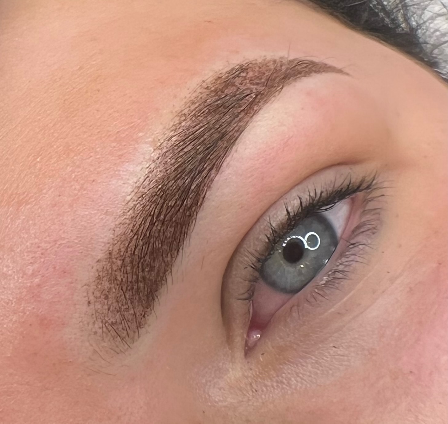 Eyebrow Treatments
