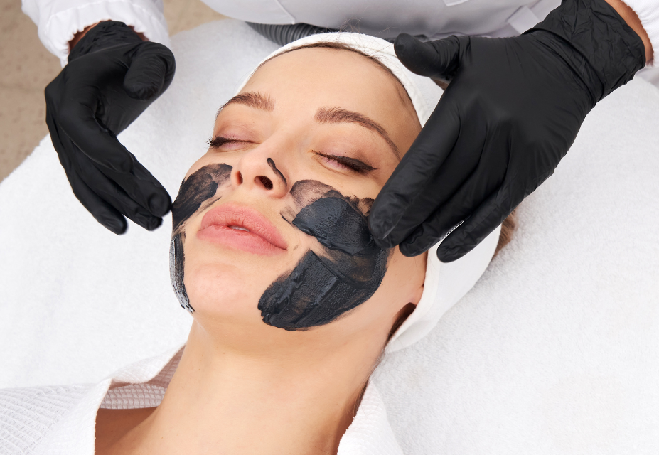 Carbon Laser Facial