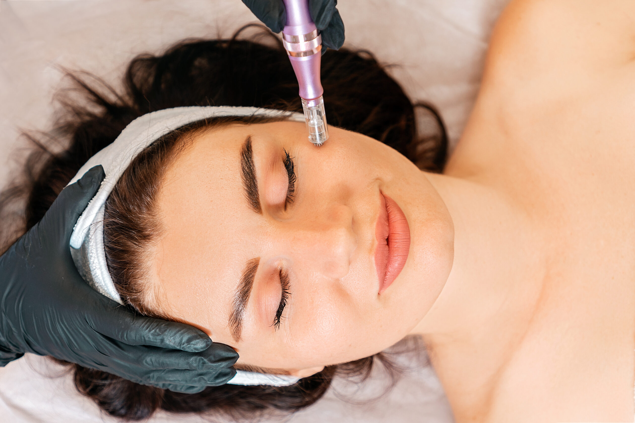 Revitalize Microneedling