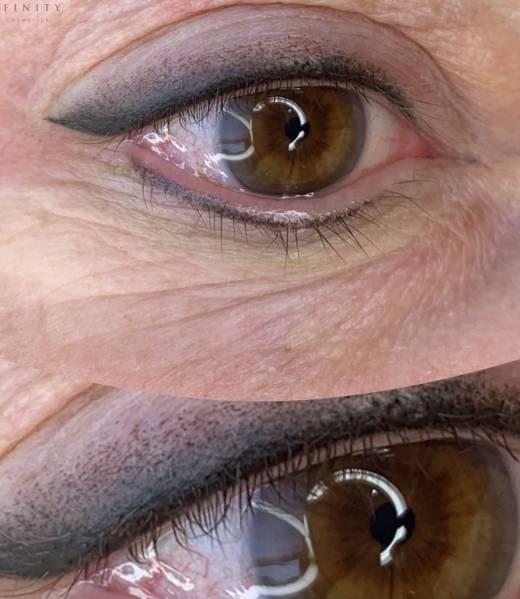 Advanced Eyeliner Training Dermafinity permanent cosmetics and